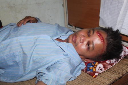 “Cẩu tặc” chém trọng thương công an xã tuần tra